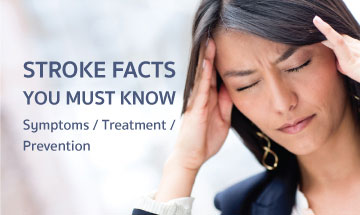 Stroke symptoms, treatment, and prevention