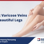 Varicose Veins Bangkok Hospital Chiang Mai