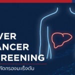 370x250-px-thumbnail-liver-cancer-2020_tha