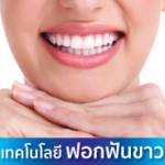 Dental_Clinic_Zoom_Whitening_2020_TH_Thumb