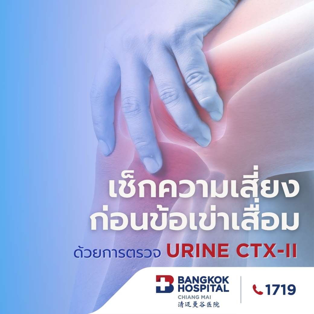 เช็กความเสี่ยงก่อนข้อเข่าเสื่อมด้วยการตรวจ Urine CTX-II